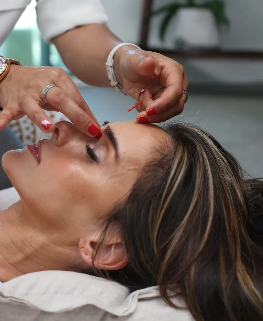 Aplicação de toxina botulínica na região da testa